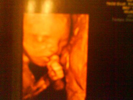 mon petit fils dans le ventre de sa maman à 4 mois de grossesse
